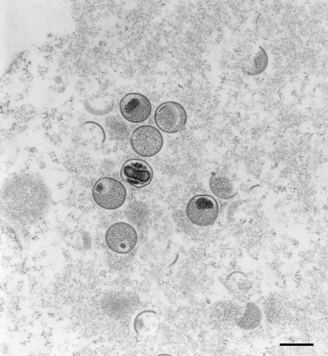원숭이 두창 바이러스를 독일 로베르트 코흐 연구소(RKI)가 2004년 전자현미경으로 촬영한 사진. /로베르트 코흐 연구소 제공.