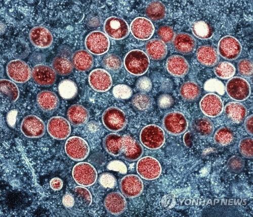 감염된 세포(푸른색 바탕) 속에서 포착된 원숭이두창 바이러스(붉은색) [AP 연합뉴스 자료사진. 재판매 및 DB 금지]