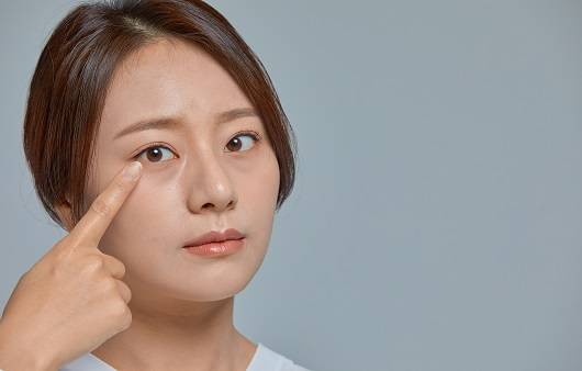 비립종ㅣ출처: 게티 이미지뱅크