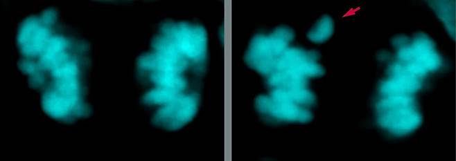 네안데르탈인의 뇌 신경세포(오른쪽)에서는 염색체 분리 과정에서 현생인류(왼쪽)보다 오류가 두 배나 많이 생겼다. 붉은색 화살표가 염색체 분리 오류가 생긴 곳이다./독일 막스플랑크연구소