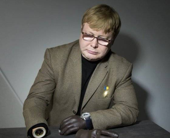 2014년부터 파르티잔 활동을 했으며 작전을 펼치던 중 두 손을 잃은 볼로디미르 젬추호프는 현재 후배 파르티잔들을 육성하고 있다. 사진 라디오프리 유럽 캡처