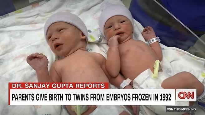 지난달 31일 30년 동안 냉동돼있던 배아에서 태어난 이란성 쌍둥이. (CNN 갈무리)