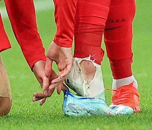 24일 오후(현지시간) 카타르 알라이얀의 에듀케이션 시티 스타디움에서 열린 2022 카타르 월드컵 조별리그 H조 1차전 대한민국과 우루과이 경기. 대한민국의 손흥민이 우루과이의 카세레스의 거친 태클에 넘어진 뒤 축구화를 신고 있다. 손흥민의 오른쪽 양말이 찢겨져 있다. 연합뉴스