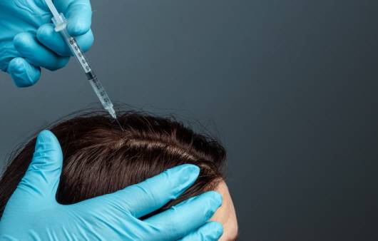 줄기세포나 레이저 등 다양한 탈모 치료법이 나오고 있다ㅣ출처: 게티 이미지뱅크