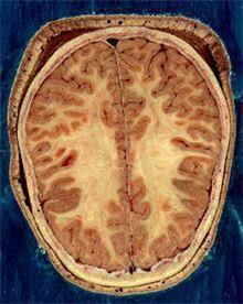 뇌의 백질과 회색질 [출처: 위키백과]