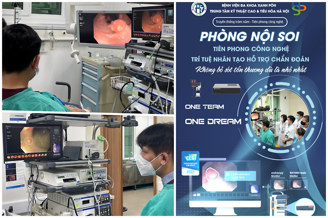베트남 하노이 세인트폴 종합병원에서 AI 내시경 검사 장비를 사용하는 모습. 오른쪽 모니터에서 AI 소프트웨어가 환자의 병변에 동그라미 표시를 그려준다.(왼쪽 위·아래) / AI 내시경 검사 장비 설치 사실을 전면에 내건 베트남 하노이 세인트폴 종합병원의 홍보물(오른쪽) [사진=웨이센·강북삼성병원]