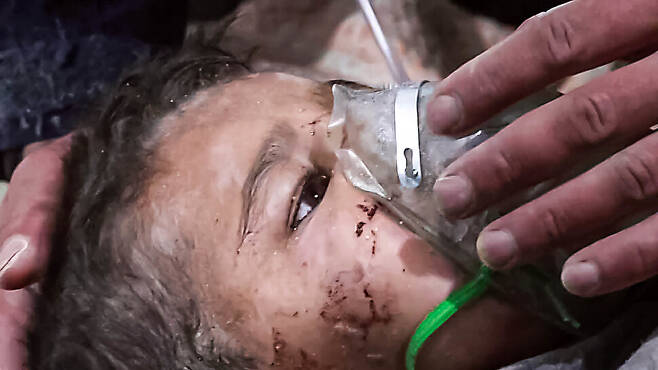 6일(현지시각) 시리아 북서부 이들리브주 주도인 이들리브에서 구조대가 지진으로 무너진 건물에 깔렸다가 구조된 어린이의 얼굴에 산소마스크를 씌워주고 있는 모습을 시리아 민간 구조단체인 시리아민간방위대(SCD)가 공개했다. 이들리브/UPI 연합뉴스