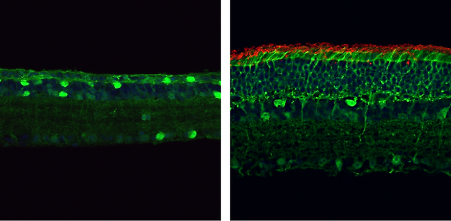 (왼쪽)유전자 돌연변이를 가진 생후 4개월 된 생쥐는 막대형 광수용체(빨간색)가 부족하다. 오른쪽은 유전자 교정을 통해 훨씬 더 두꺼운 망막을 가지게 된 모습. 실험의학저널 제공