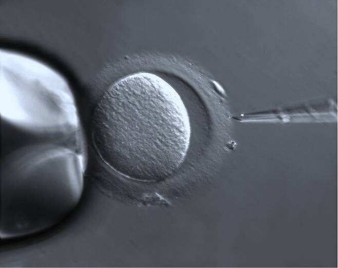 시험관 아기 절차 중에 촬영한 난모세포. 출처: 위키피디아
