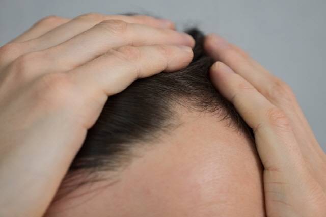 탈모약 복용 후 발기부전이 생겼다면 발기부전 치료제를 추가로 복용해 문제를 해결할 수 있다. /게티이미지뱅크