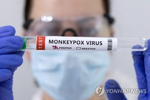 엠폭스 바이러스 양성 반응 보인 검체 [로이터 연합뉴스 자료사진. 재판매 및 DB 금지]