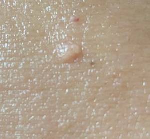 사진=헬스조선DB