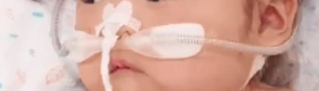 지구양이 소아중환자실에서 보낼 때 간호사들이 바꿔준 머리 모양과 하트 모양으로 자른 콧줄 고정 테이프다. 인스타그램 jigoo_____ 캡처