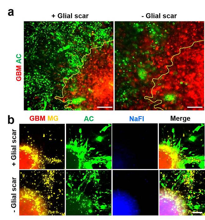 성균관대는 14일 조한상 교수 연구팀이 이창준 기초과학연구원 단장, 윤미진 연세대 교수와의 공동 연구를 통해 공격적인 뇌종양인 '교모 세포종' 치료법을 개발했다고 밝혔다.