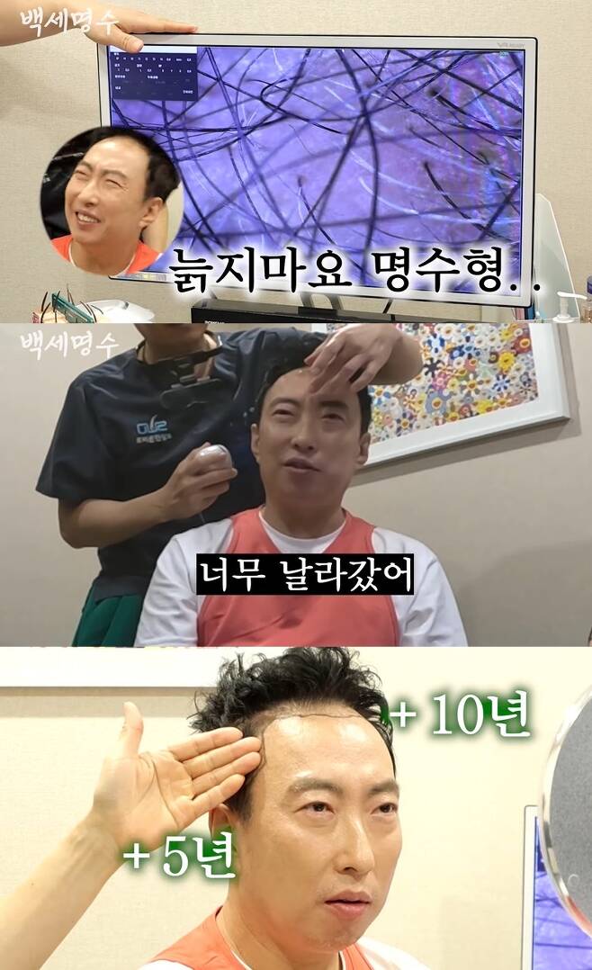 Park Myeong-su has revealed his hair condition.On October 5th, a video titled Park Myeong-su, a hair loss that finally came to receive hair transplantation, was released on the  ⁇   ⁇   ⁇   ⁇   ⁇   ⁇   ⁇   ⁇   ⁇   ⁇   ⁇   ⁇   ⁇   ⁇   ⁇   ⁇   ⁇   ⁇   ⁇   ⁇   ⁇   ⁇   ⁇   ⁇   ⁇   ⁇   ⁇   ⁇   ⁇   ⁇   ⁇   ⁇  of  ⁇  studio brick  ⁇  channel.In the video, Park Myeong-su went to Han Sang-bo, a hair transplant specialist. Park Myeong-su said, I have a lot of hair on my old screen. I have a lot of hair due to seborrheic dermatitis.Its easy to get rid of febrile dermatitis because its a reaction to sex hormones, said Han Sang-bo.But I can not do this, he said.Han Sang-bo, who started to check the hair condition of Park Myeong-su, said, My brother is also old. I was saddened to see that he had gray hair. Park Myeong-su said,Park Myeong-sus parietal hair was thin and the spacing between the hairs was wide. On the other hand, you can tear the back of the hair for hair transplantation.When I started to check the transplant site, Park Myeong-su was sorry for the genotype M hair loss, saying that it flew too far.Han Sang-bo, who recommended 3,000 transplants, painted Park Myeong-sus expected hairline after transplantation and said 15 years would be younger.Park Myeong-su, who checked the hair condition directly and visited the operating room, decided to transplant hair.