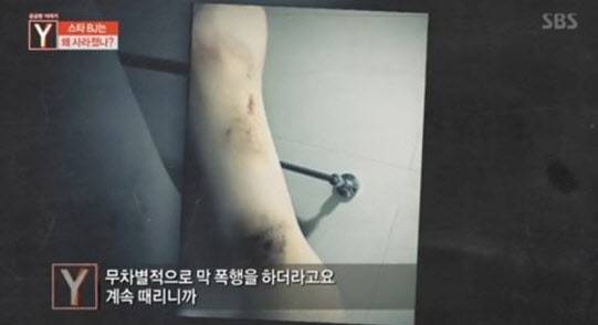 (사진=‘궁금한 이야기 Y’ 방송 캡처)