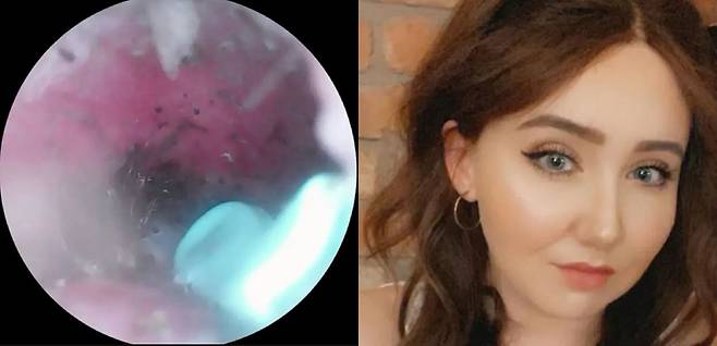 영국에서 사는 루시 와일드(30)는 귀에서 소리가 나 살펴보니 거미를 발견했다./사진=더 선