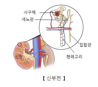 신장의 구조와 신부전. 사진 서울아산병원