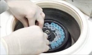 일본 의료진이 환자 치료에 활용할 줄기세포를 분리하고 있다. 한경DB