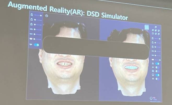 인공지능(AI)과 증강현실(VR) 기술로 구현한 치아 시뮬레이터 시스템. AI가 환자의 미소에 어울리는 치아 형태를 제시하면 이를 상담 과정에 적용한다. VR이 구현한 모습을 통해 세밀한 수정 작업도 들어간다. 이어 3D프린팅을 거쳐 치아 구조물을 완성해 사용한다. 사진=박선혜 기자