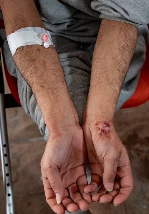 이스라엘군에 잡혀있던 팔레스타인 포로(사진)가 석방된 뒤 그들로부터 학대를 받았다고 주장했다. 유엔은 해당 내용을 담은 보고서를 16일 공개했다. EPA 연합뉴스