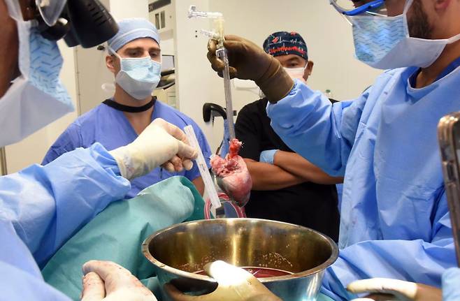 미국 메릴랜드대 연구팀이 돼지 심장 이식 수술을 준비하고 있는 모습. /사진=미국 메릴랜드대