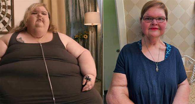 테미 슬래튼의 체중 감량 전(왼쪽)과 최근  모습. 사진출처=TLC, 뉴스위크