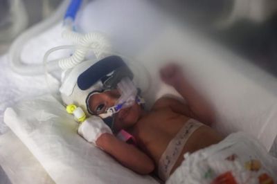이스라엘 공습으로 중상을 입은 엄마 뱃속에서 기적적으로 태어난 사브린 알루. 그러나 건강이 악화해 닷새 만에 사망했다. [이미지출처=연합뉴스]