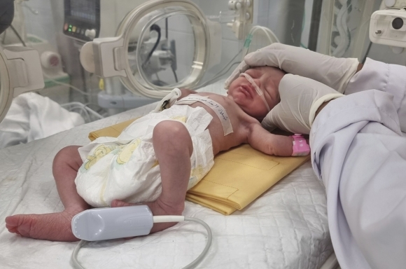 지난 20일 이스라엘군의 공습 과정에서 숨진 팔레스타인 여성의 배 속에 있던 아기가 제왕절개로 태어났으나 5일 만에 숨졌다. AP 연합뉴스