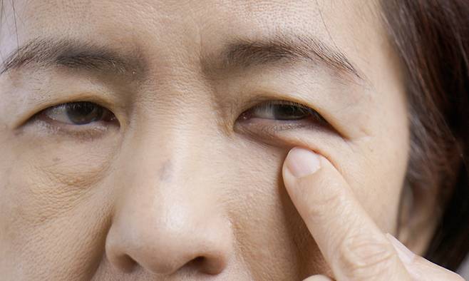 기사의 이해를 돕기 위한 자료 사진. 게티이미지뱅크 제공