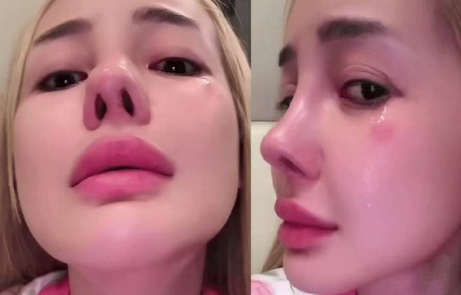 한국에서 원정 성형수술 받은 베트남 유명 DJ가 수술 후 코 모양이 이상해졌다며 눈물을 쏟아내는 영상이 화제다. /사진=틱톡 캡쳐