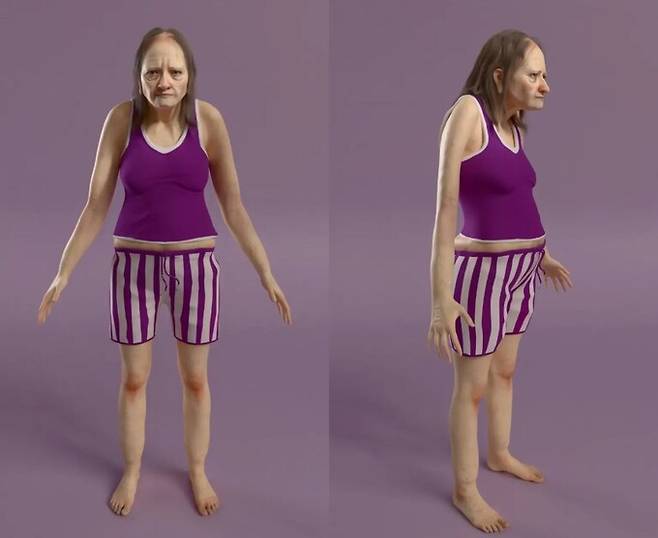 하루 6시간밖에 잠을 자지 못한 가상의 인물 '한나'의 25년 뒤 모습. 벤슨스 포 베드즈 홈페이지 캡처