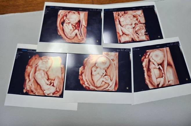 사진=서울성모병원