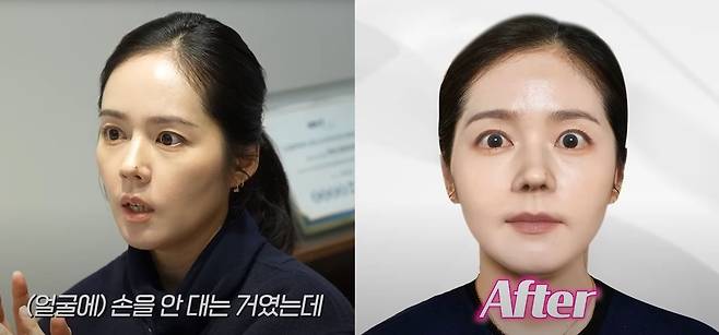 배우 한가인(42)이 인생 첫 성형외과 상담을 받는 모습이 공개됐다./사진=유튜브 채널 ‘자유부인 한가인’ 캡처