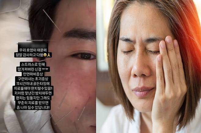 ⓒ이민우 SNS캡처, 게티이미지뱅크