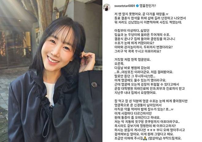 ⓒ별 SNS 갈무리