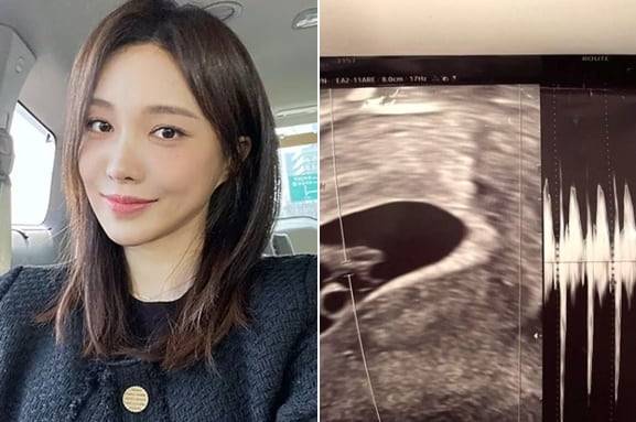 '하트시그널3' 출신 인플루언서 서민재가 공개한 태아 초음파 사진./인스타그램