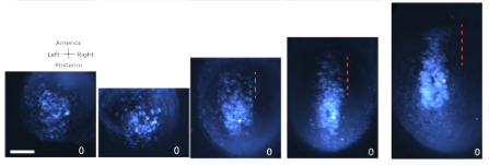 광시트 현미경으로 촬영한 심장을 형성하기 위한 배아의 단계별 변화.