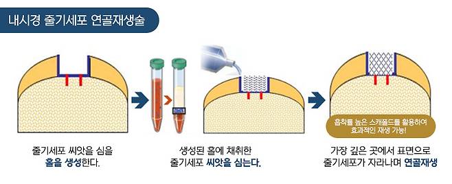 연세건우병원 제공
