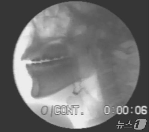 1994년 당시 촬영한 동영상 캡쳐. 2025.05.13/뉴스1(세종대왕기념사업회 제공)