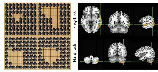 사진 왼쪽의 바둑판 과제 상단은 집 크기 차이가 많이 나는 쉬운 과제, 하단은 집 크기 차이가 적은 어려운 과제. 사진 오른쪽 각 과제 수행 시 바둑프로기사와 일반인들 사이에 대뇌의 활성화의 유의미한 차이가 나는 부위. 한국기원 제공