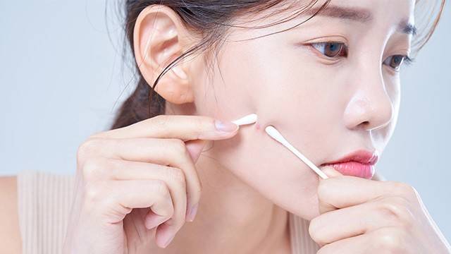 여드름은 털을 만드는 모낭에 붙어 있는 피지선에 발생하는 만성 염증성 질환이다|출처: 클립아트코리아