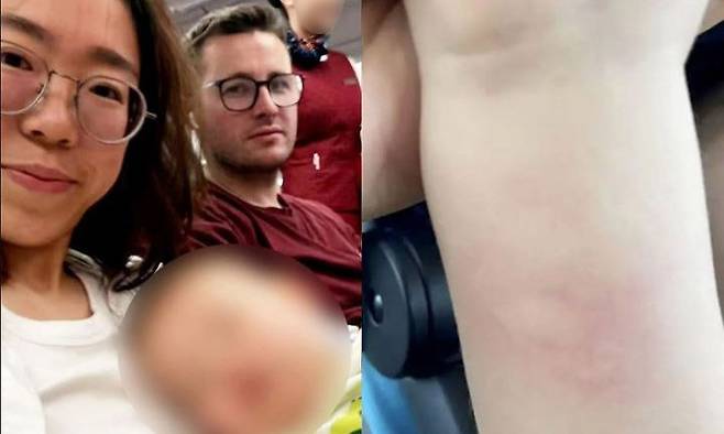 조너선 아서/뉴시스