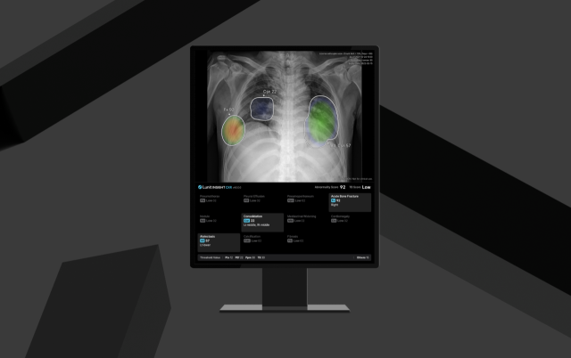 루닛 인사이트 CXR4. 사진제공=루닛