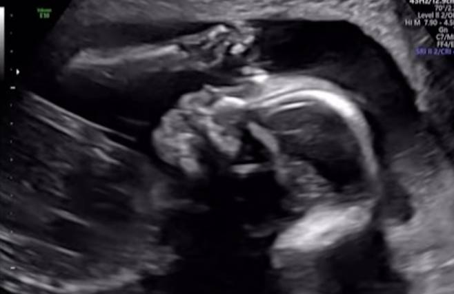 /사진=임정희 SNS