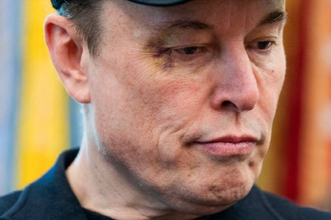 눈가에 멍이 든 일론 머스크 테슬라 최고경영자.(사진=AFP)