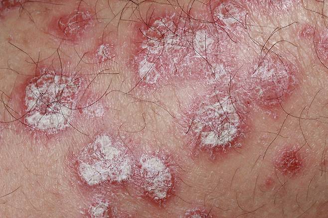 사진=게티이미지뱅크.