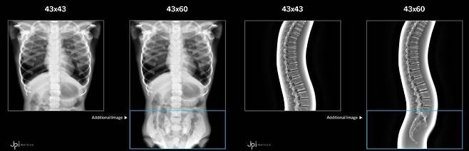 이동형 토모신세시스로 촬영한 흉부와 척추 사진. 다양한 각도에서 신체를 촬영해 의료진의 정확한 진단을 돕는다. /제이피아이헬스케어