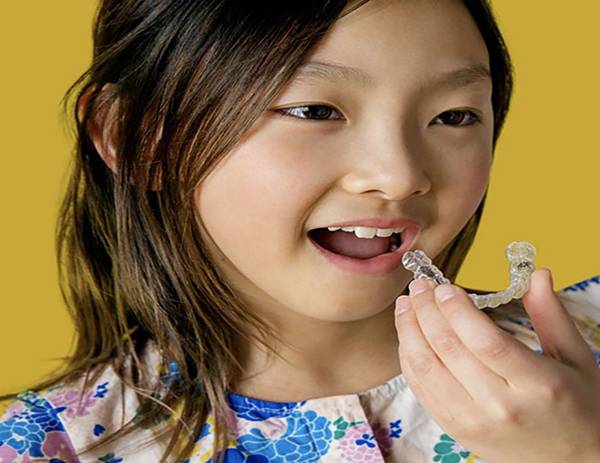 투명교정장치(사진 上)와 어린이가 투명교정장치를 끼우고 있는 모습.<전남대학교치과병원 제공>