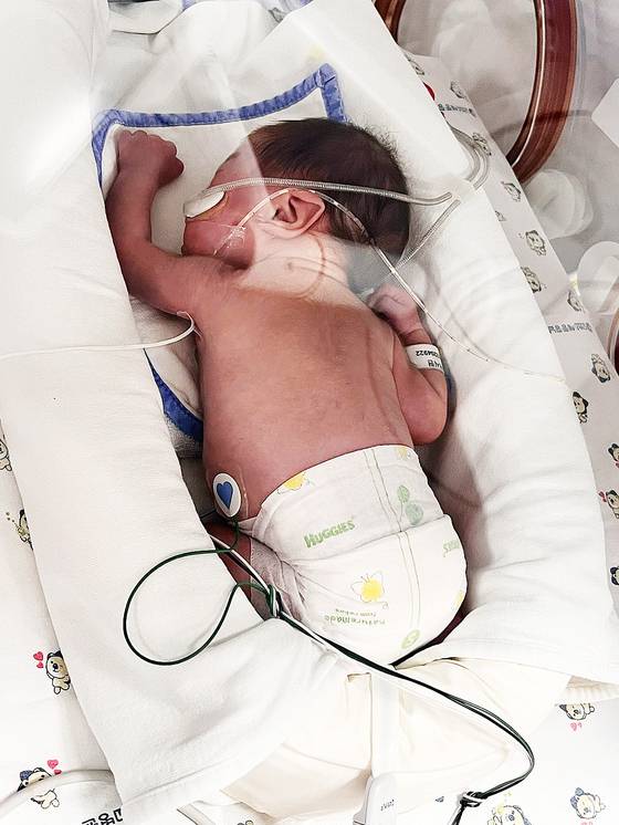 신생아중환자실(NICU)에 입원한 신민정씨 둘째 딸 이시현양. 임신 26주 만에 600g로 태어난지 5주 뒤 찍은 사진이다. 신민정씨 제공